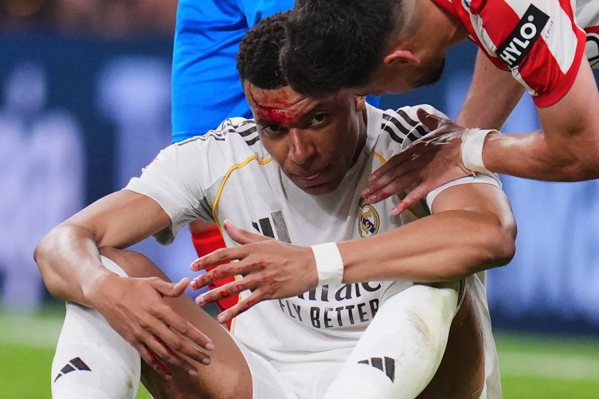 تعادل ريال مدريد مع جيرونا في الدوري الإسباني