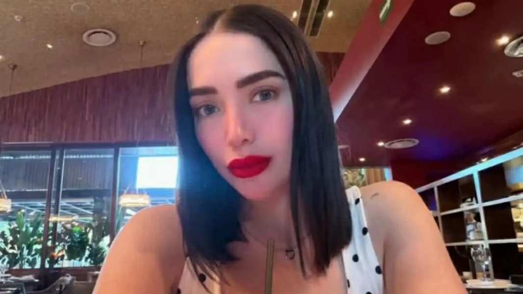 وفاة مؤثرة مكسيكية خلال عملية تجميل