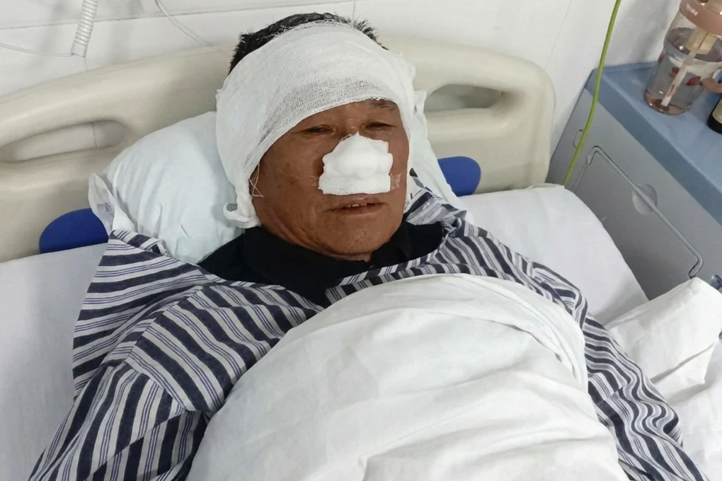 بطل يومي: رجل صيني يفقد أنفه أثناء إنقاذ امرأة
